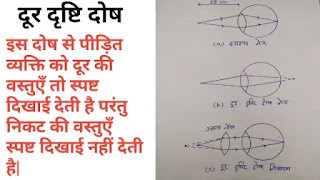 निकट दृष्टि दोष और दूर दृष्टि दोष|myopia and Hypermetropia in hindi