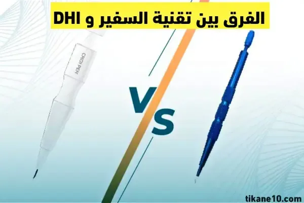 الفرق بين تقنية السفير و DHI لزراعة الشعر