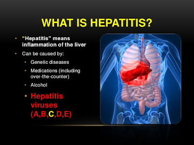 Hepatitis facts