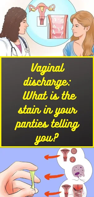 Vaginal discharge: What is the stain in your panties telling you?
