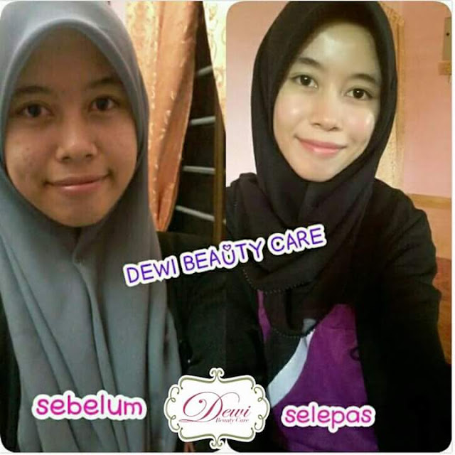 Dewi Beauty Care Skincare Murah