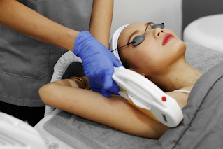 Laser Hair Removal