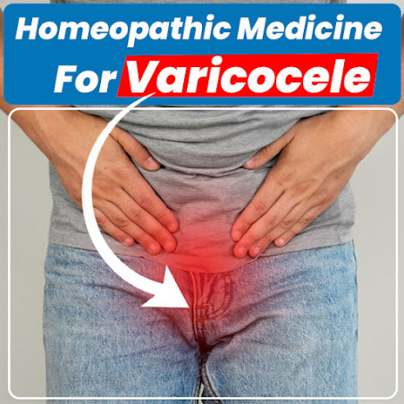 varicocele non surgical treatment