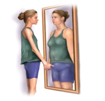 anorexia3