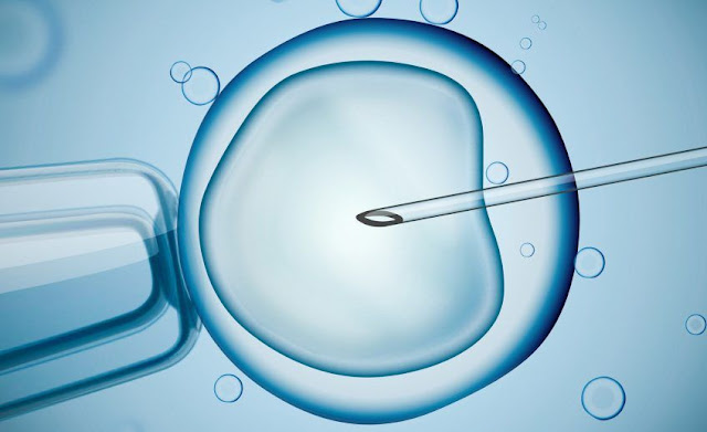 intracytoplasmic sperm injection, ICSI, IVF, in vitro fertilization, ICSI treatment, risks of an ICSI treatment, intracytoplasmic sperm injection success, fertility sperm injection, ICSI technology, sperm injection, why intracytoplasmic sperm injection, IVF treatment, Intracytoplasmic sperm injection process,   Intracytoplasmic Sperm Injection risks