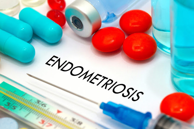 Rawatan penyakit endometriosis