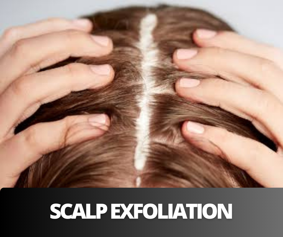 Scalp exfoliation