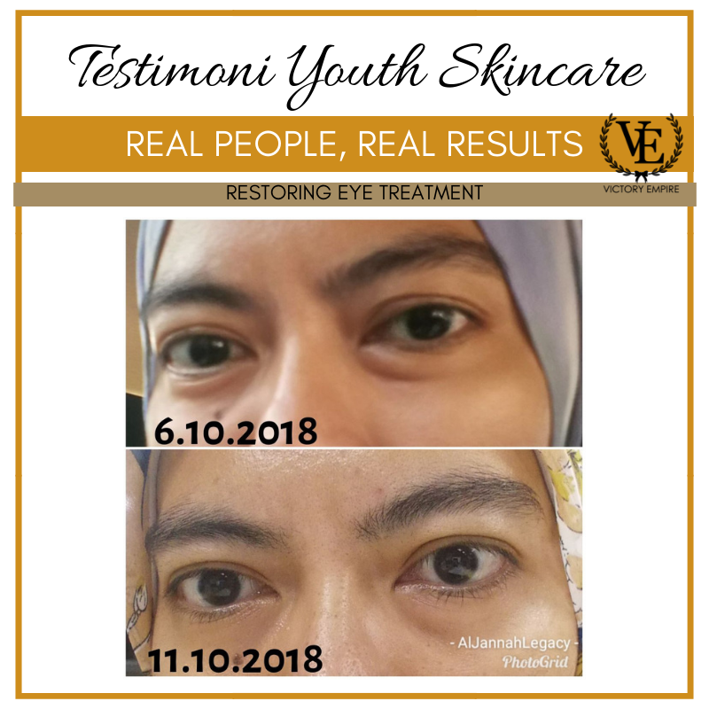 Testimoni Youth Restoring Eye Treatment Shaklee