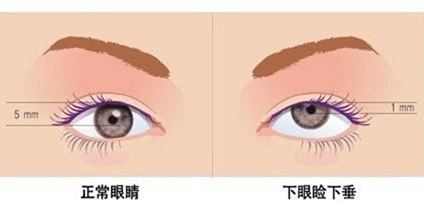 clip_image002