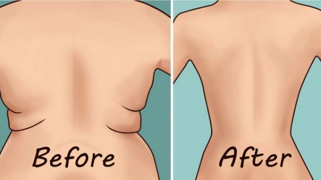 8 Effective Exercises To Get Rid Of Folds On Your Back And Sides