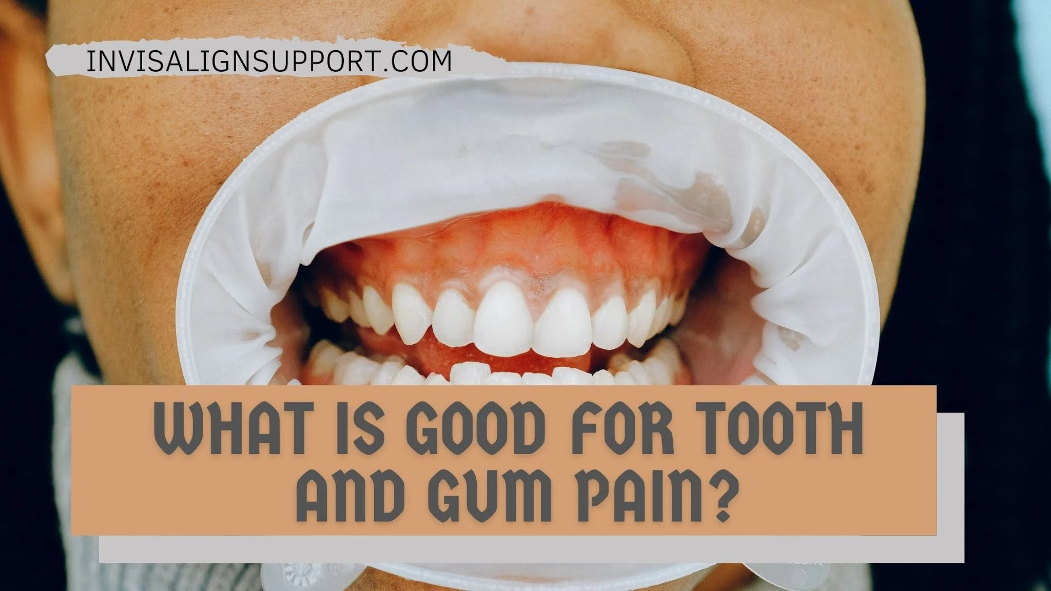 What Is Good For Tooth and Gum Pain?