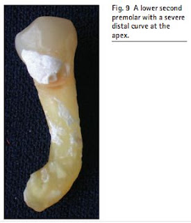 MANDIBULAR FIRST PREMOLAR