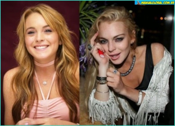 Famosos Drogados Antes E Depois - Imagens de famosos drogados antes e depois