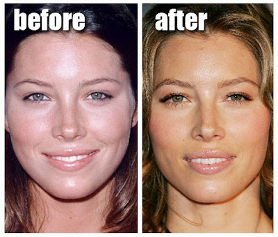 lady gaga nose job photos. Jessica Biel Nose Job