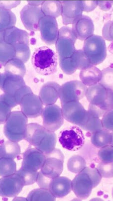 Imagen de un Basofilo - Valores Normales de Leucocitos 