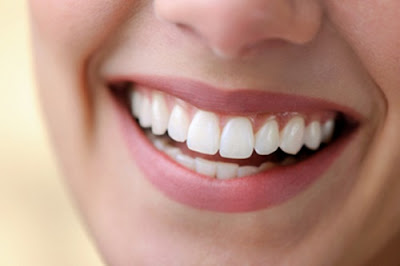 Nguyên nhân răng sứ bị đen viền nướu 