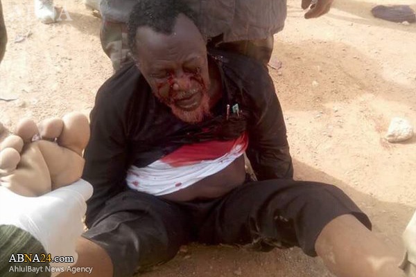 Photo: The First Shaikh Zakzaki's Painful Image Published; Leader of Islamic Movement Severely Injured and in Critical Condition