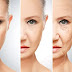  Use a few tips from a dermatologist to get rid of wrinkles and pimples