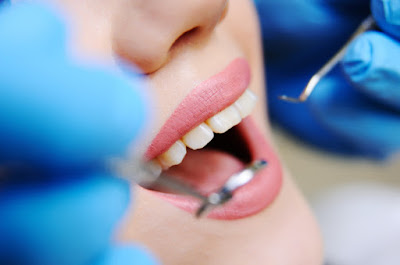 Lamine Dişlerin Tedavi Süreçleri