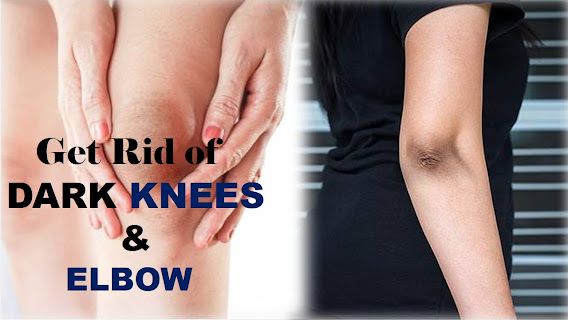 Tips to get rid of dark knee and elbow : Dark knees and Elbow