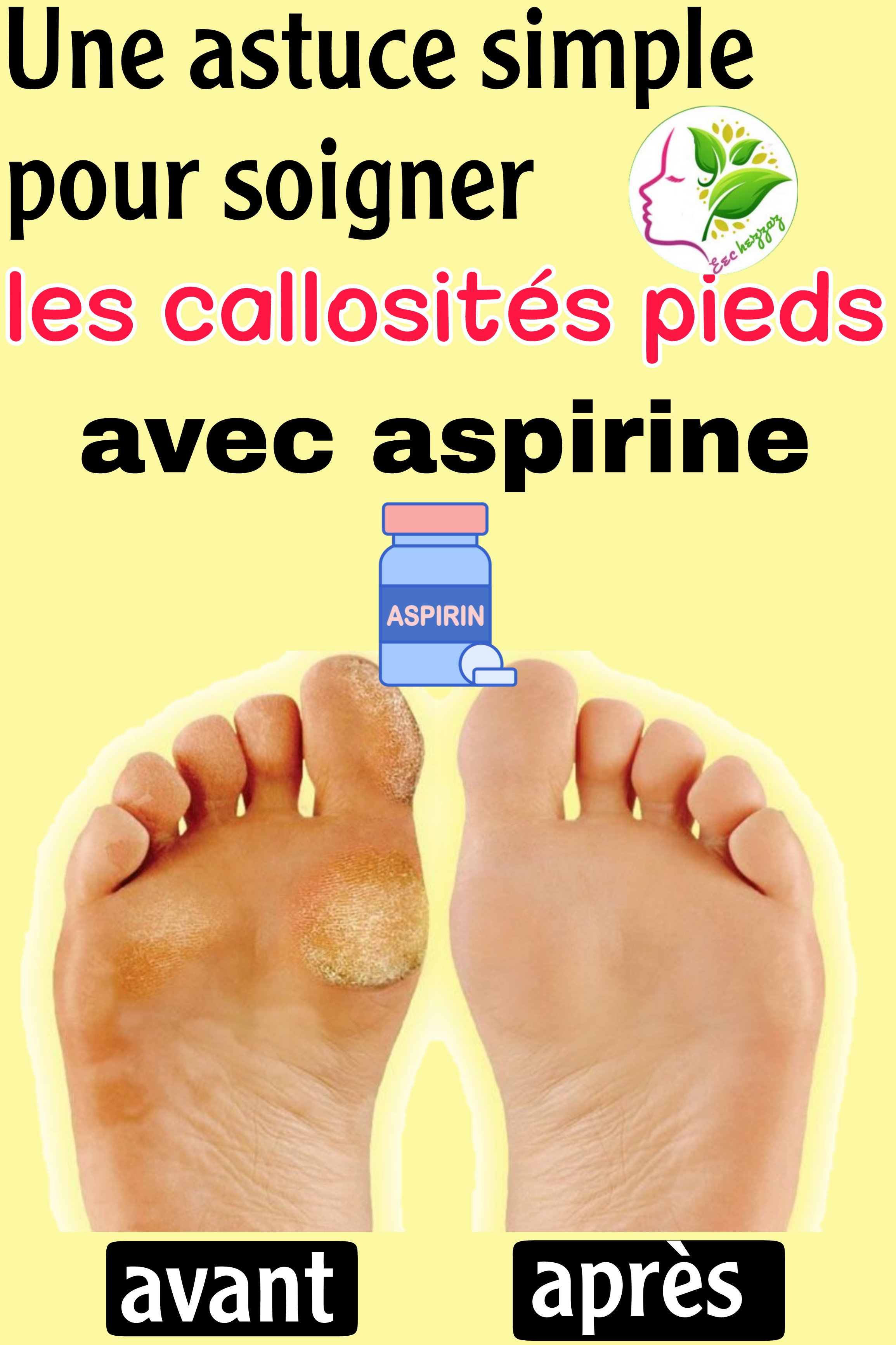 Une astuce simple pour soigner les callosités pieds avec aspirine