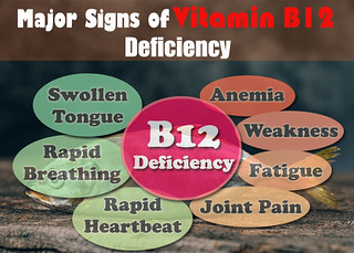 Vitamin B12 Deficiency: Causes, Symptoms, and Treatment-Know About Vitamin B12