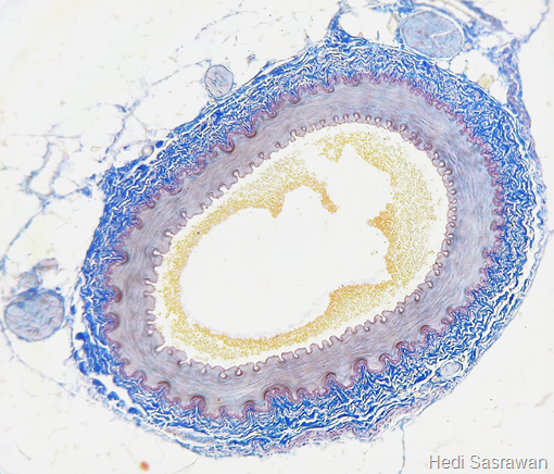 potongan melintang arteri