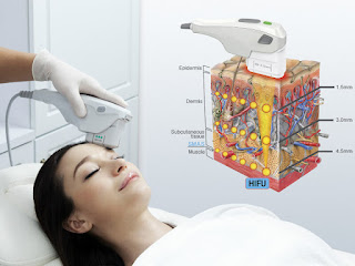 best hifu machine professional