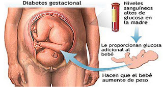 Cuando una mujer padece de diabetes gestacional, este se presenta en una etapa avanzada durante el embarazo la causa de la diabetes 