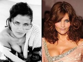 Helena Christensen Breast Implants Before and After