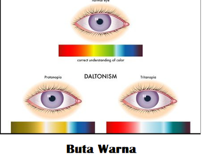 cara mengatasi buta warna