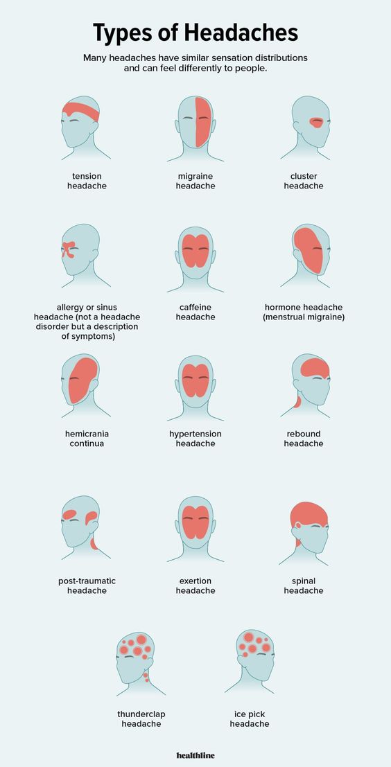 Headache | Types of headaches | Migraine | Tension headache | Occipital neuralgia | Cluster headaches | Sinus headache | Ocular migraine