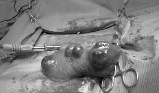 恩澤動物醫院的寵物腫瘤案例：黃金獵犬BUBU有嚴重的脾臟腫瘤。