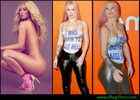 Iggy Azalea revela acidente com depilacao