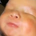 Kondisi Langka, Bayi Ini Terlahir Tanpa Mata