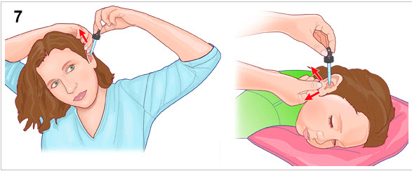 طريقة-استخدام-قطرات-الأذن-3