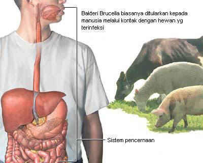 Cara penularan bruselosis