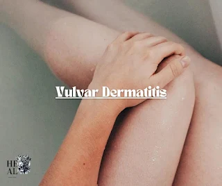 Arthritis Septic