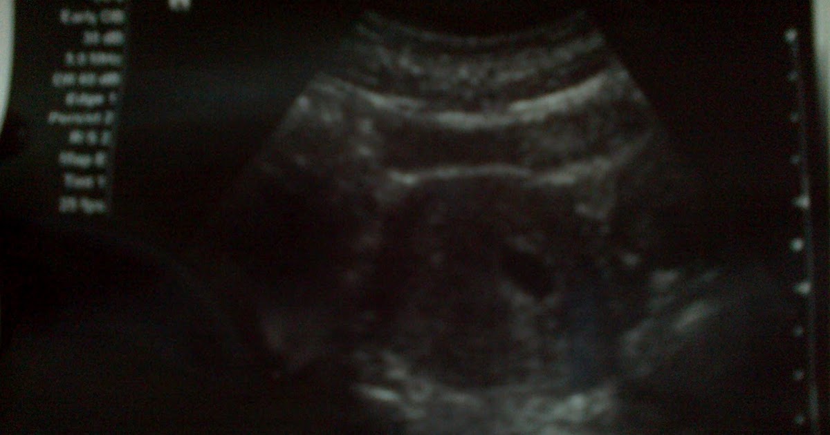Little Diary: ScAn BaBy