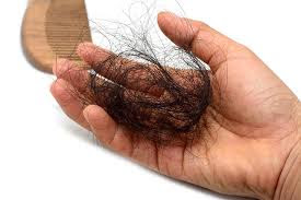 Pada umumnya orang mengalami kerontokan rambut dalam sehari berkisar antara 50 hingga 100 helai helai rambut. Begitu pendapat yang dilansir badan penelitian American Academy of Dermatology. Jika rambut kita yang rontok dalam seharinya lebih dari itu, maka kita patut khawatir jangan-jangan kita sedang terjangkit tiga penyakit di bawah ini.