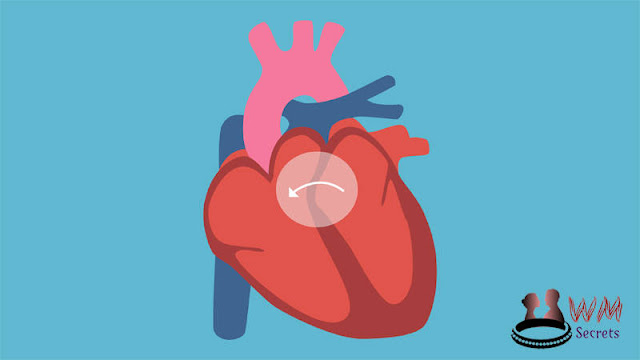 Congenital Heart Defects