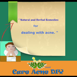 Natural and Herbal remedies to get rid of Acne