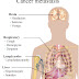 Understanding Cancer -Symptoms