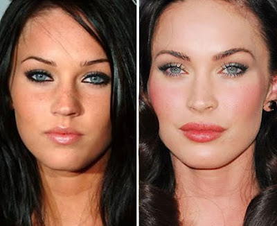megan fox plastic surgery before and after