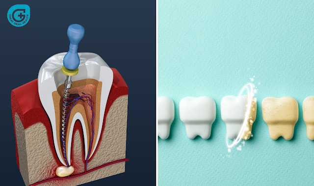 Difference Between Dentin and Enamel