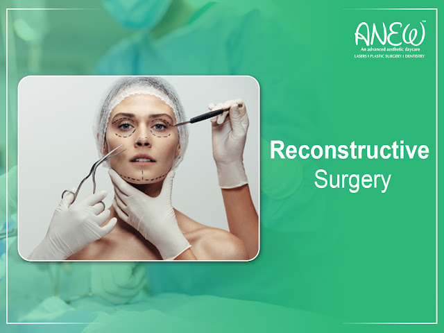 Reconstructive surgery in Bangalore