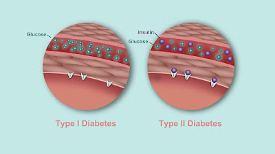 Testing for diabetes