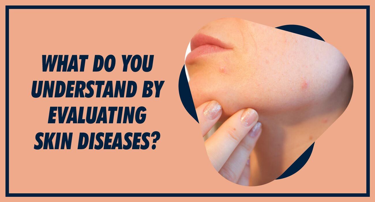 What do you understand by Evaluating Skin Diseases?