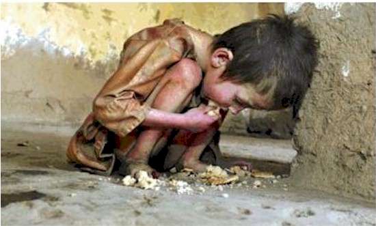 starving children in africa. These children are not