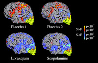 Effect of scopolamine and lorazepam on memory using fMRI